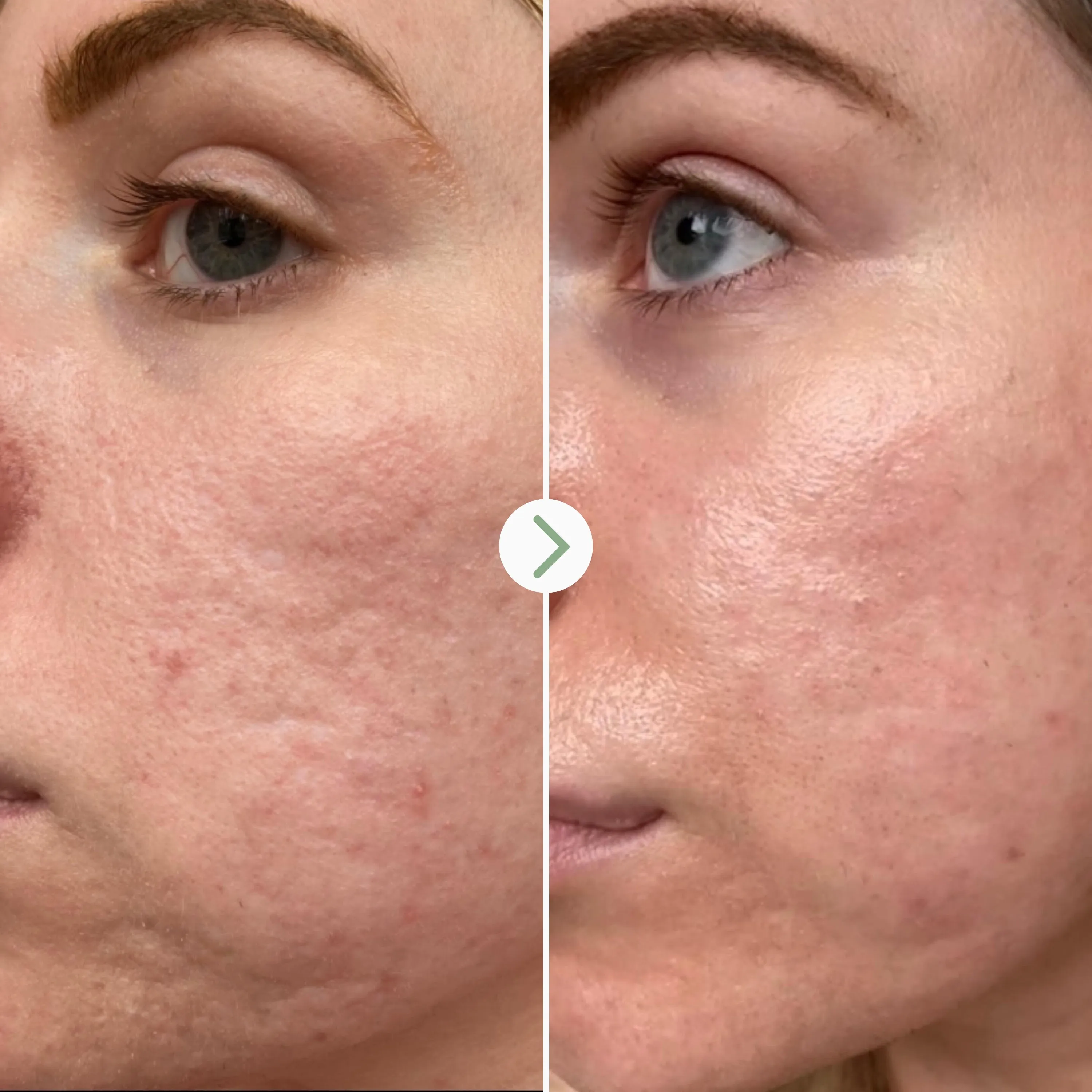 a tinted moisturizer,bubble moisturizer